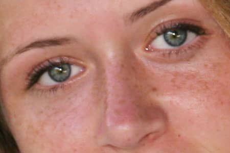 Remove Freckles - Photoshop Tutorials